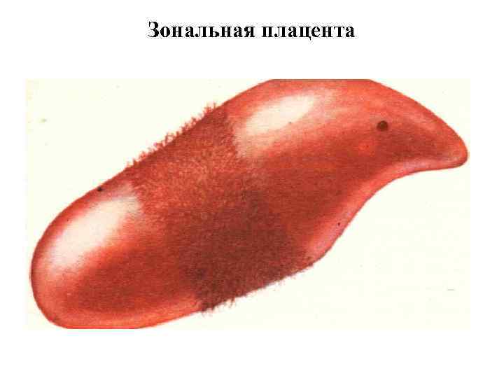 Зональная плацента 