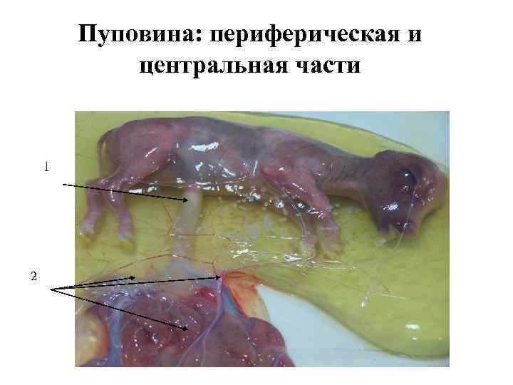 Пуповина: периферическая и центральная части 1 2 