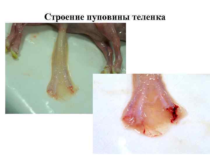 Строение пуповины теленка 