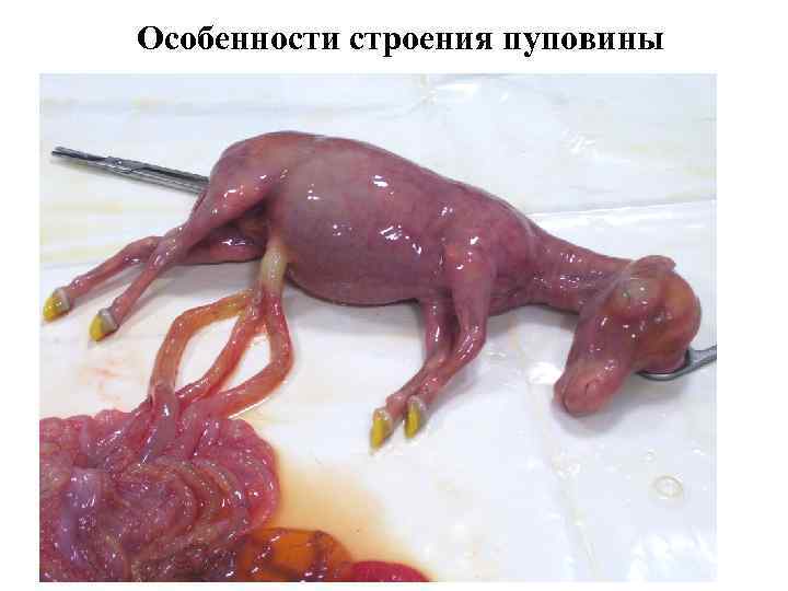 Особенности строения пуповины 