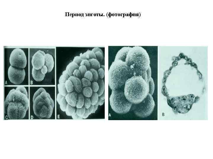Период зиготы. (фотография) 