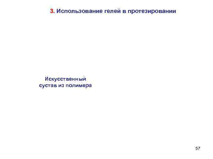 3. Использование гелей в протезировании Искусственный сустав из полимера 57 