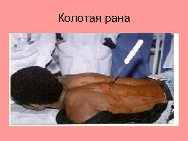 Колотая рана 