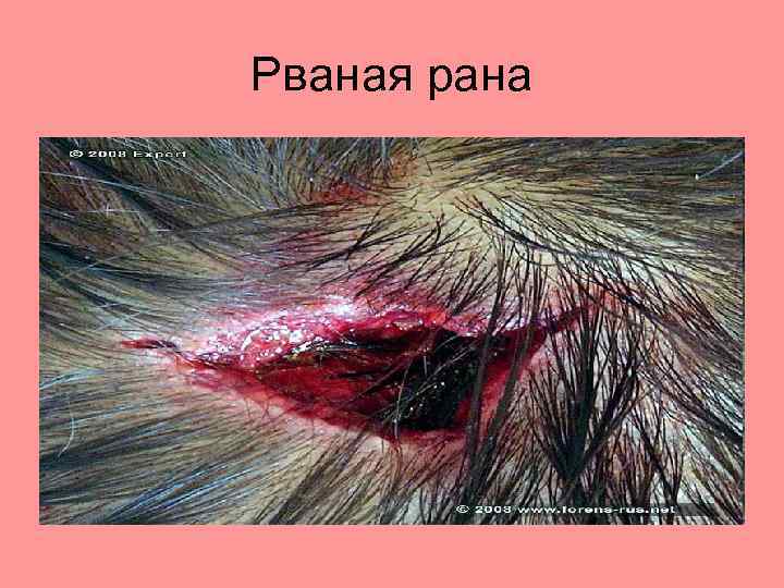 Рваная рана 