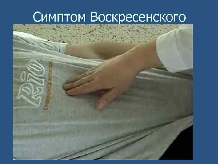 Симптом Воскресенского 
