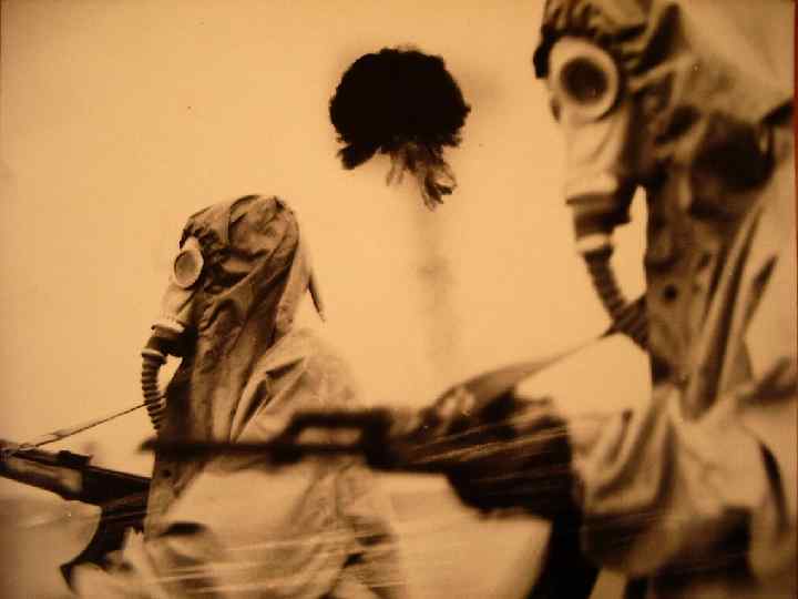 ЛУЧЕВЫЕ ОЖОГИ 