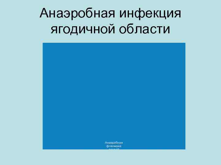 Анаэробная инфекция ягодичной области 