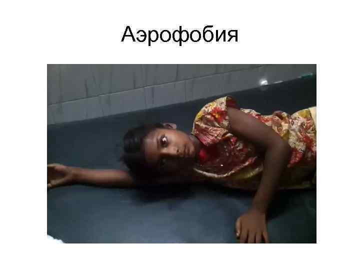 Аэрофобия 