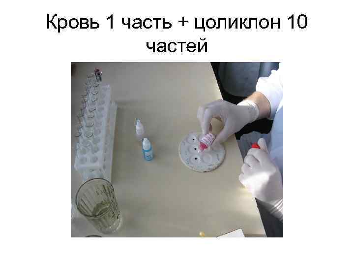 Кровь 1 часть + цоликлон 10 частей 