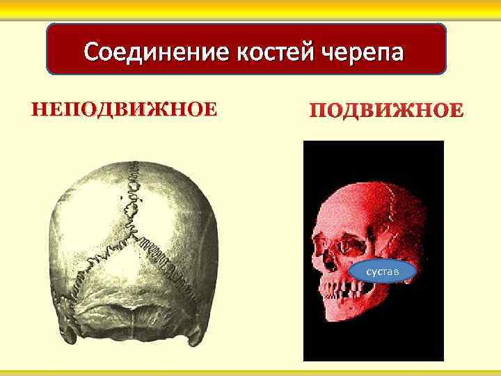 Соединение костей черепа НЕПОДВИЖНОЕ сустав 