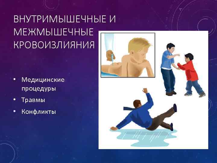 ВНУТРИМЫШЕЧНЫЕ И МЕЖМЫШЕЧНЫЕ КРОВОИЗЛИЯНИЯ • Медицинские процедуры • Травмы • Конфликты 