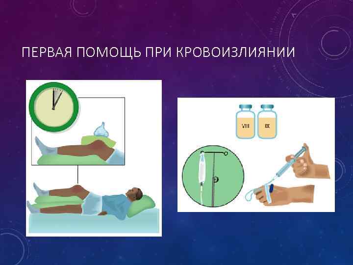 ПЕРВАЯ ПОМОЩЬ ПРИ КРОВОИЗЛИЯНИИ 