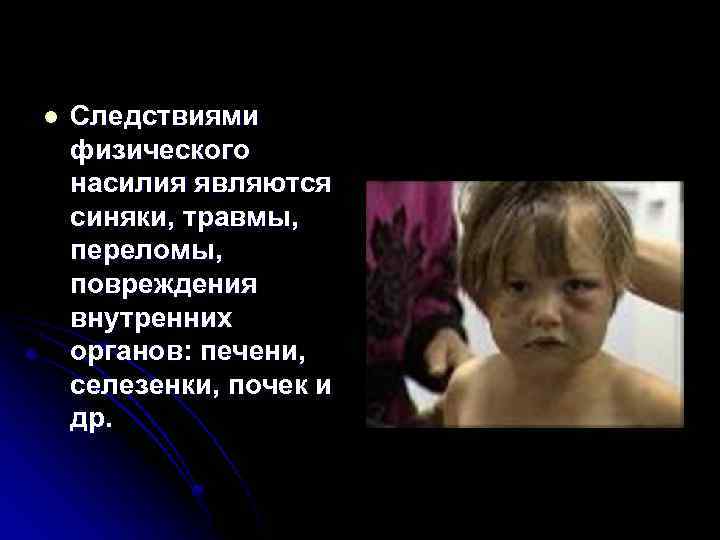 l Следствиями физического насилия являются синяки, травмы, переломы, повреждения внутренних органов: печени, селезенки, почек
