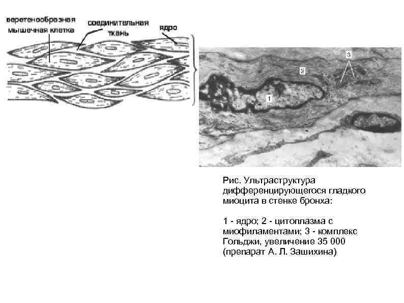 Схема изменения структуры гладкого миоцита до и после сокращения