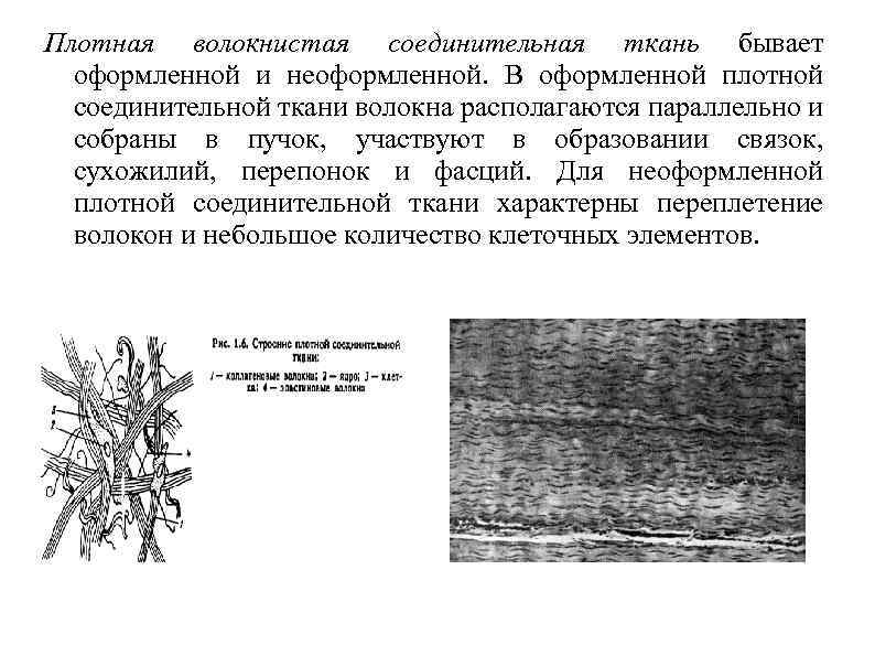 Плотная волокнистая неоформленная соединительная ткань рисунок