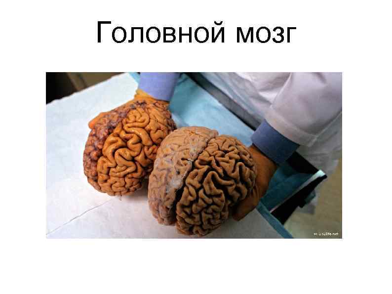Головной мозг 