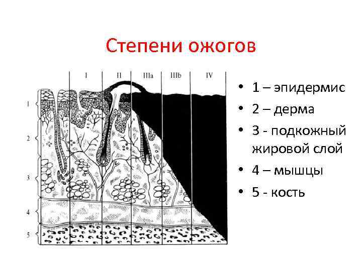 Степени кожи