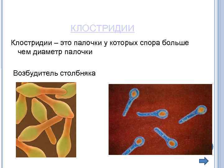 КЛОСТРИДИИ Клостридии – это палочки у которых спора больше чем диаметр палочки Возбудитель столбняка