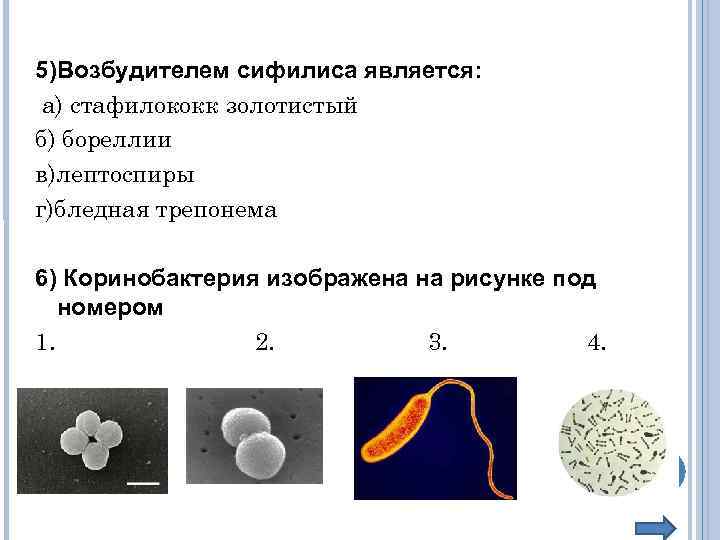 5)Возбудителем сифилиса является: а) стафилококк золотистый б) бореллии в)лептоспиры г)бледная трепонема 6) Коринобактерия изображена