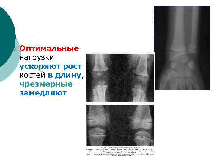 ¡ Оптимальные нагрузки ускоряют рост костей в длину, чрезмерные – замедляют 