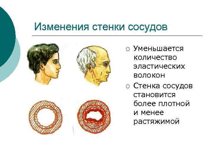 Изменения стенки сосудов ¡ ¡ Уменьшается количество эластических волокон Стенка сосудов становится более плотной