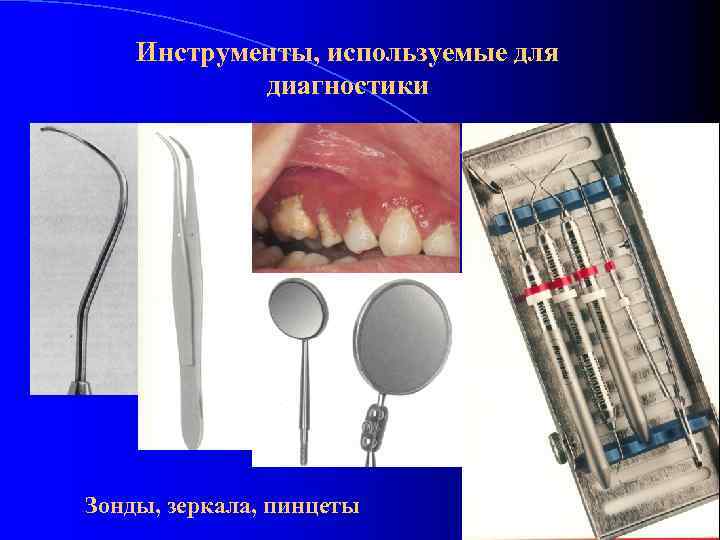Инструменты, используемые для диагностики Зонды, зеркала, пинцеты 