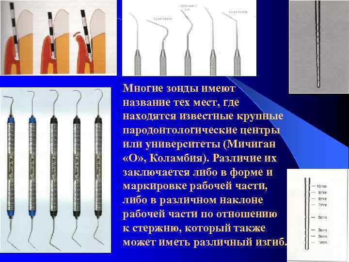 Многие зонды имеют название тех мест, где находятся известные крупные пародонтологические центры или университеты