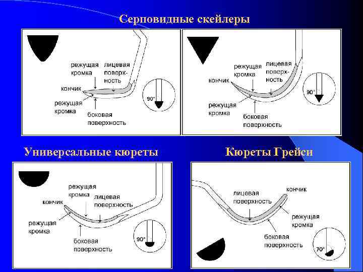 Серповидные скейлеры Универсальные кюреты Кюреты Грейси 