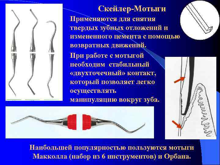 Скейлер-Мотыги Применяются для снятия твердых зубных отложений и измененного цемента с помощью возвратных движений.