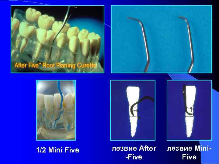 1/2 Mini Five лезвие After -Five лезвие Mini. Five 