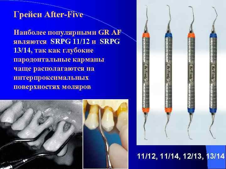 Грейси After-Five Наиболее популярными GR AF являются SRPG 11/12 и SRPG 13/14, так как