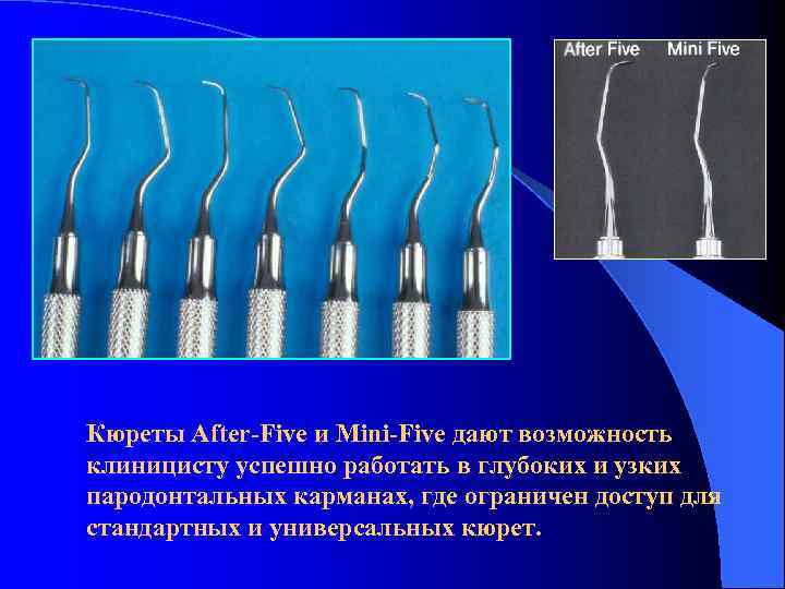 Кюреты After-Five и Mini-Five дают возможность клиницисту успешно работать в глубоких и узких пародонтальных
