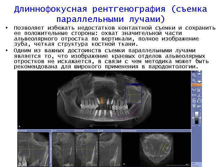 Рентгенологическое исследование при котором получают изображение исследуемого объекта