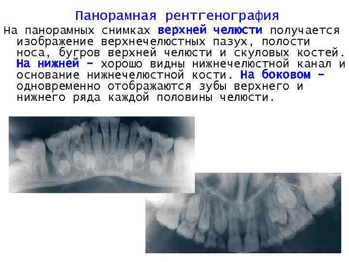 Почему на рентгеновском снимке изображение костей получается белым