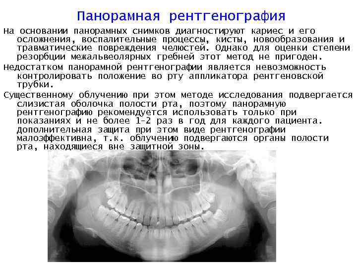 Пример описания рентгенограммы