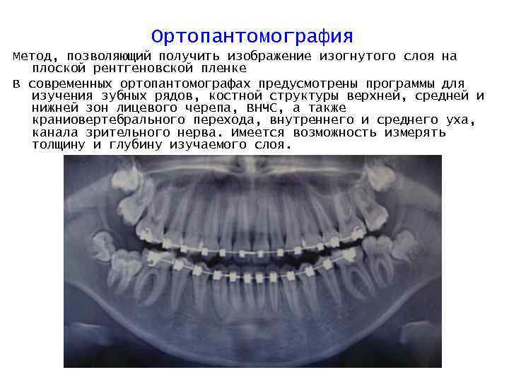 Изображение получаемое на рентгеновской пленке тест