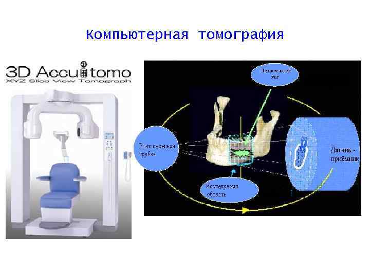 В каких случаях показана компьютерная рентгеновская томография пораженного сустава тест