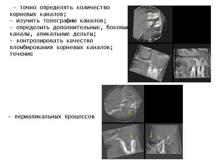  - точно определять количество корневых каналов; - изучить топографию каналов; - определить дополнительные,