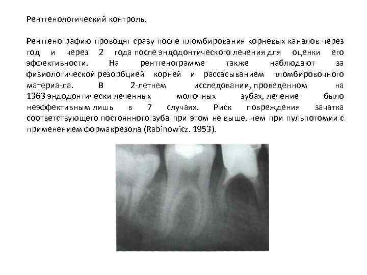Рентгенологический контроль. Рентгенографию проводят сразу после пломбирования корневых каналов через год и через 2