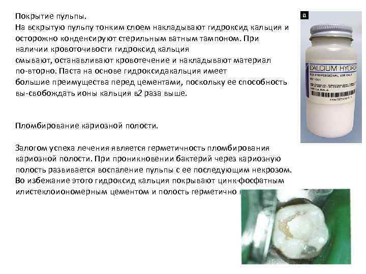 Покрытие пульпы. На вскрытую пульпу тонким слоем накладывают гидроксид кальция и осторожно конденсируют стерильным