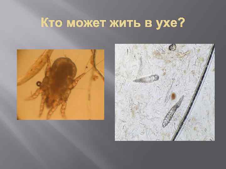 Кто может жить в ухе? 