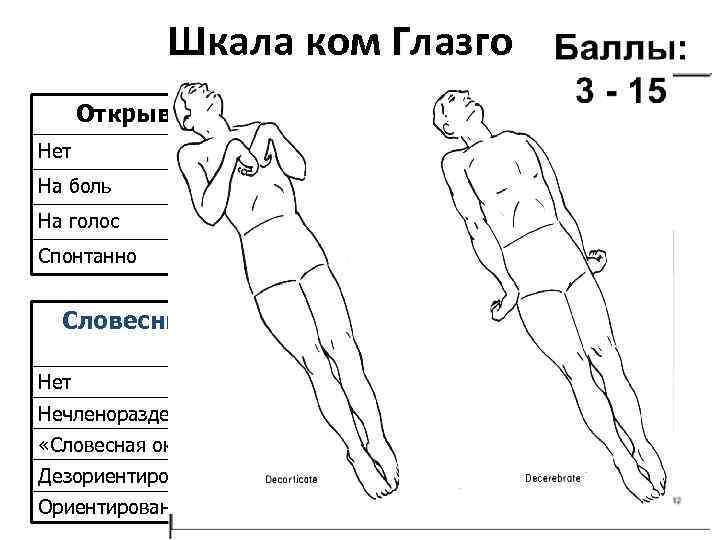 Шкала ком Глазго Двигательная реакция Открывание глаз Нет 1 На боль 2 На голос