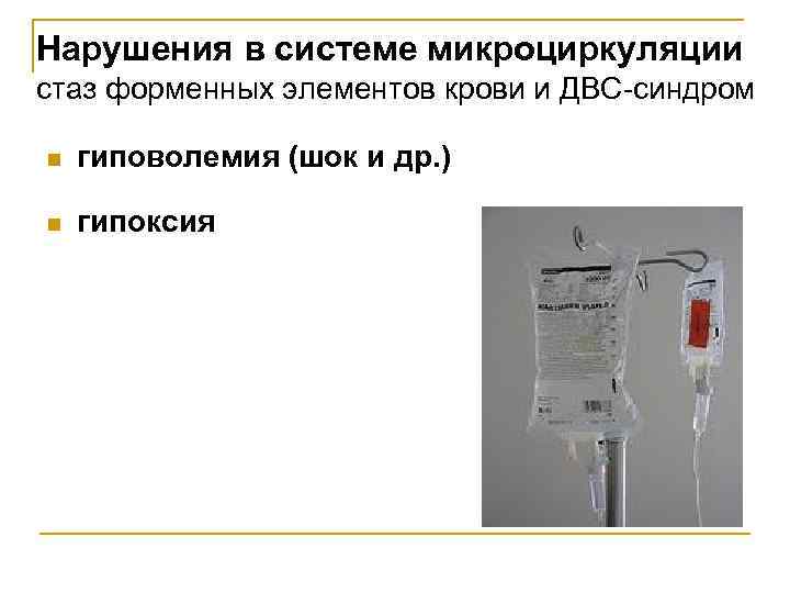 Нарушения в системе микроциркуляции стаз форменных элементов крови и ДВС-синдром n гиповолемия (шок и