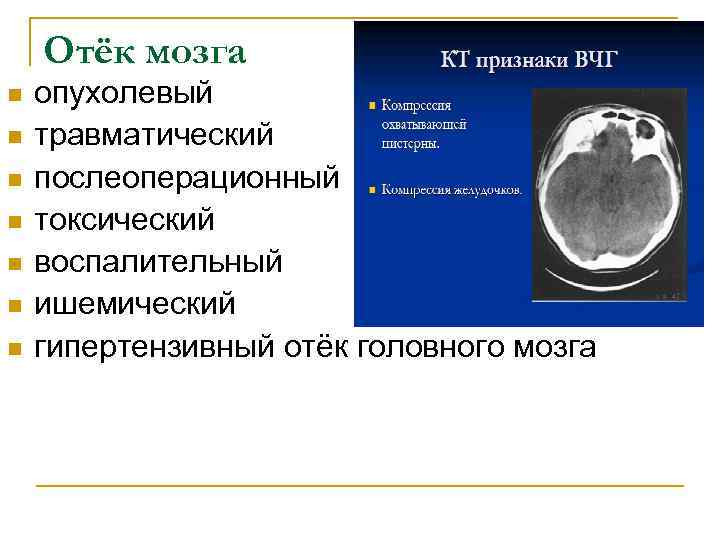 Клинический отек мозга