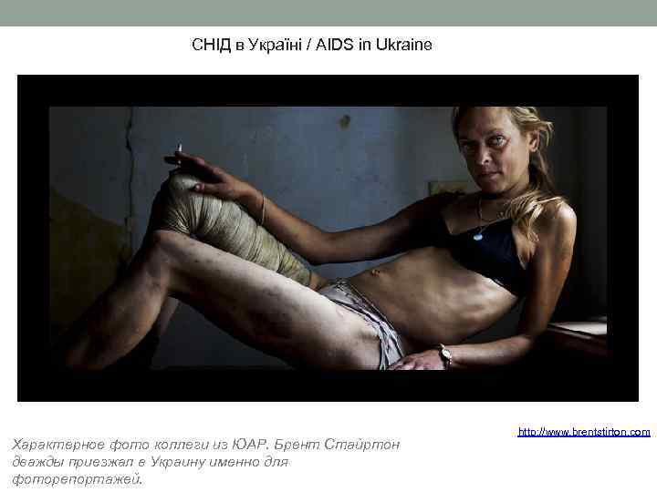 СНІД в Україні / AIDS in Ukraine Характерное фото коллеги из ЮАР. Брент Стайртон