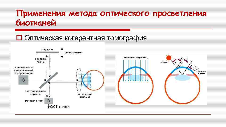 Применения метода оптического просветления биотканей o Оптическая когерентная томография 