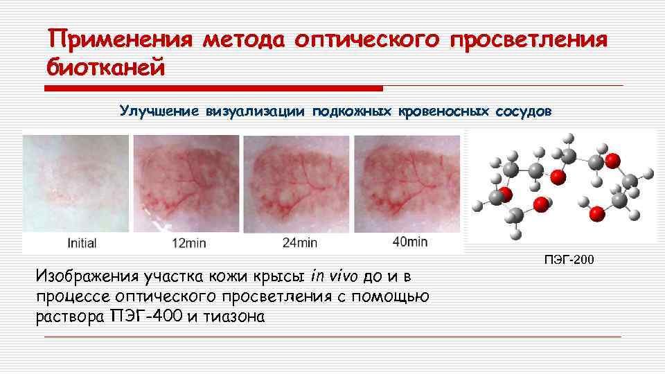 Применения метода оптического просветления биотканей Улучшение визуализации подкожных кровеносных сосудов Изображения участка кожи крысы