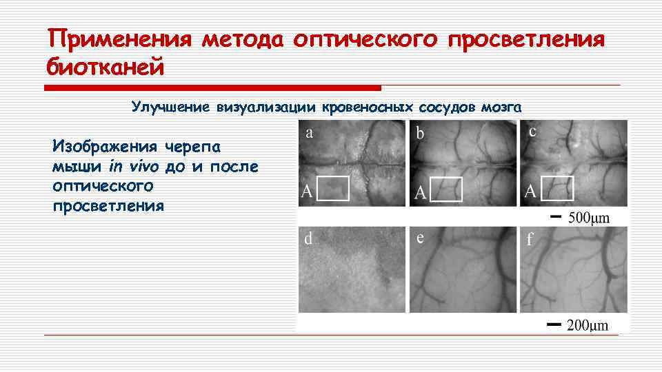 Применения метода оптического просветления биотканей Улучшение визуализации кровеносных сосудов мозга Изображения черепа мыши in