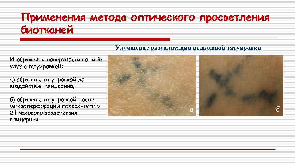 Применения метода оптического просветления биотканей Улучшение визуализации подкожной татуировки Изображения поверхности кожи in vitro