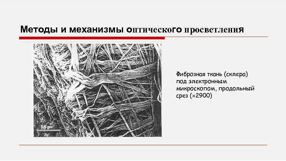 Методы и механизмы оптического просветления Фиброзная ткань (склера) под электронным микроскопом, продольный срез (